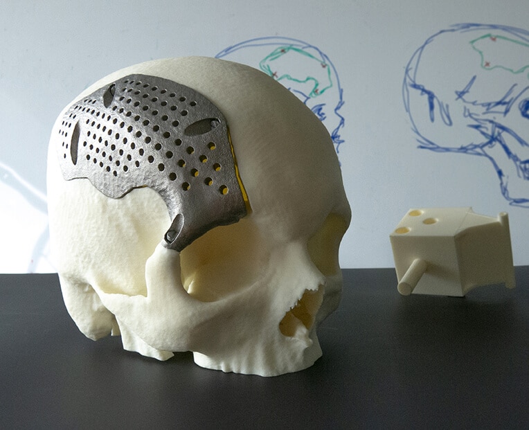 3D Yazıcı ile Ne Basabilirsin? – En Faydalı ve İlginç Baskılar!